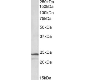 Western Blot - Anti-PSMB3 Antibody (A84864) - Antibodies.com