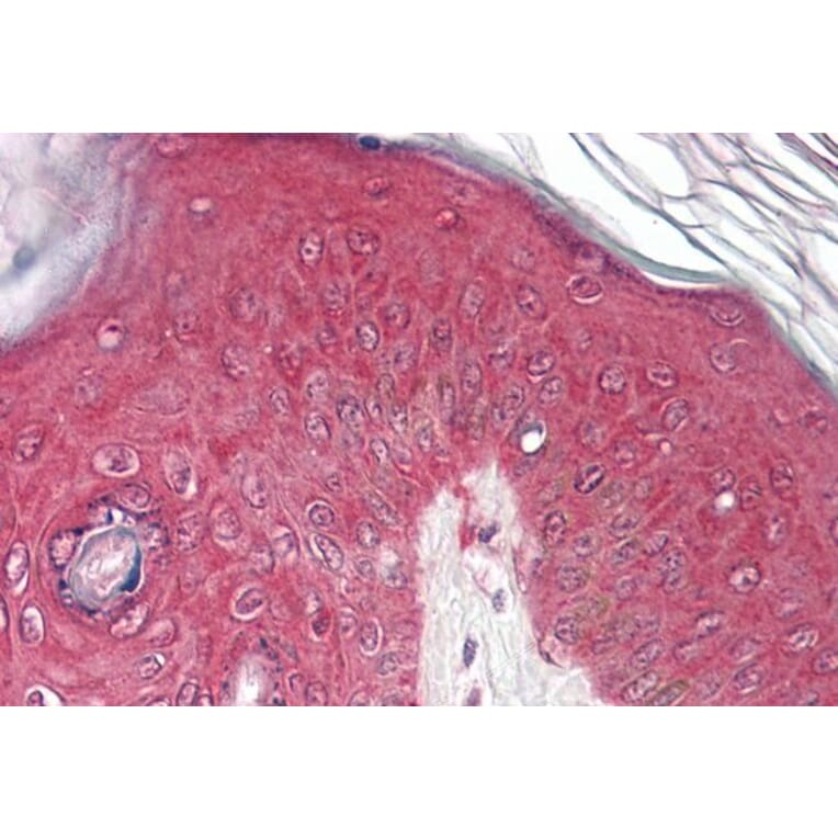 Immunohistochemistry - Anti-PSMB4 Antibody (A84865) - Antibodies.com