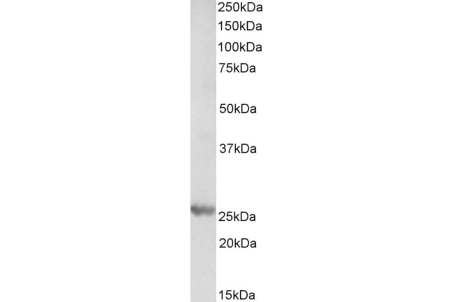 Western Blot - Anti-PSMB4 Antibody (A84866) - Antibodies.com