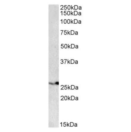 Western Blot - Anti-PSMB4 Antibody (A84866) - Antibodies.com