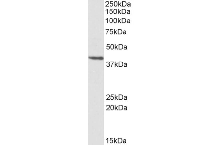 Western Blot - Anti-PSMB7 Antibody (A84867) - Antibodies.com