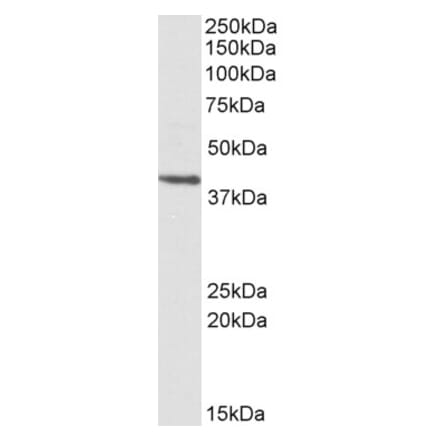 Western Blot - Anti-PSMB7 Antibody (A84867) - Antibodies.com