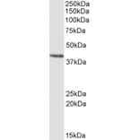 Western Blot - Anti-PSMB7 Antibody (A84867) - Antibodies.com