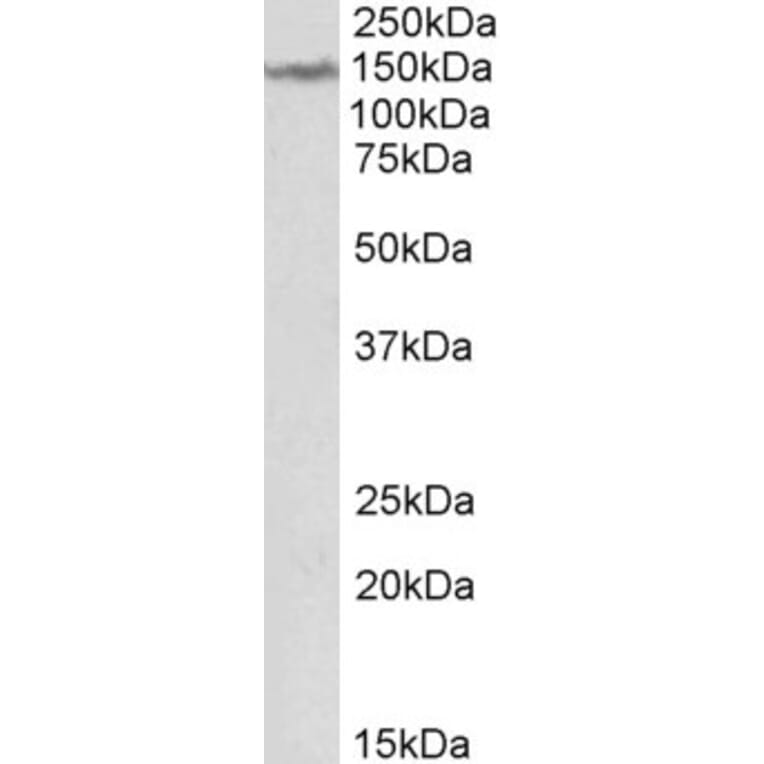 Western Blot - Anti-LMTK2 Antibody (A84868) - Antibodies.com
