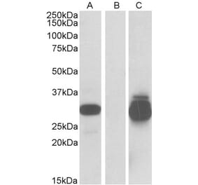 Western Blot - Anti-DESI2 Antibody (A84870) - Antibodies.com