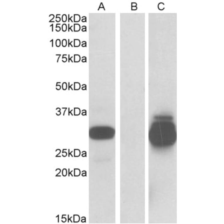 Western Blot - Anti-DESI2 Antibody (A84870) - Antibodies.com