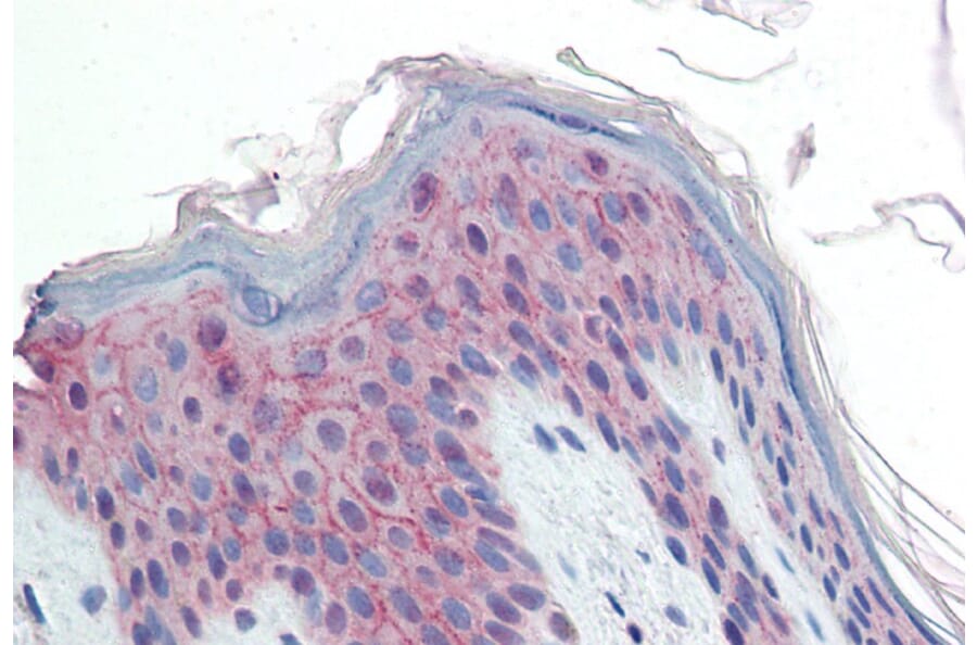 Immunohistochemistry - Anti-DESI2 Antibody (A84870) - Antibodies.com