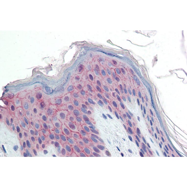 Immunohistochemistry - Anti-DESI2 Antibody (A84870) - Antibodies.com