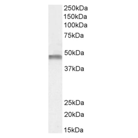 Western Blot - Anti-PAH Antibody (A84871) - Antibodies.com