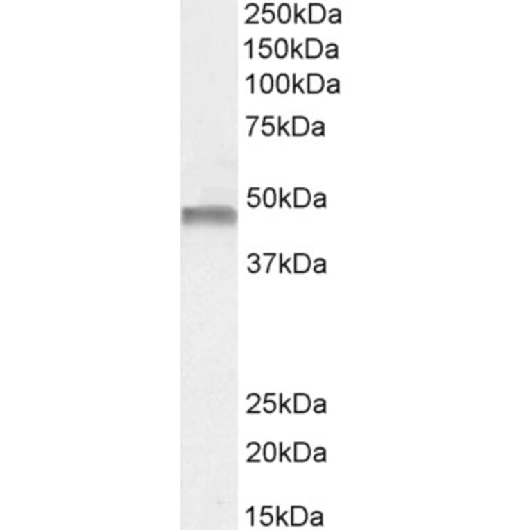 Western Blot - Anti-PAH Antibody (A84871) - Antibodies.com