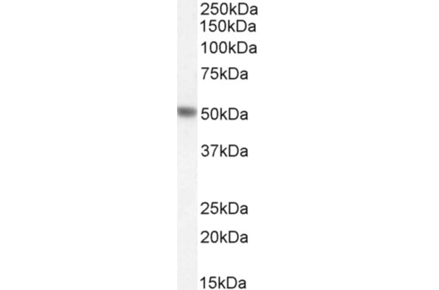 Western Blot - Anti-PAH Antibody (A84871) - Antibodies.com