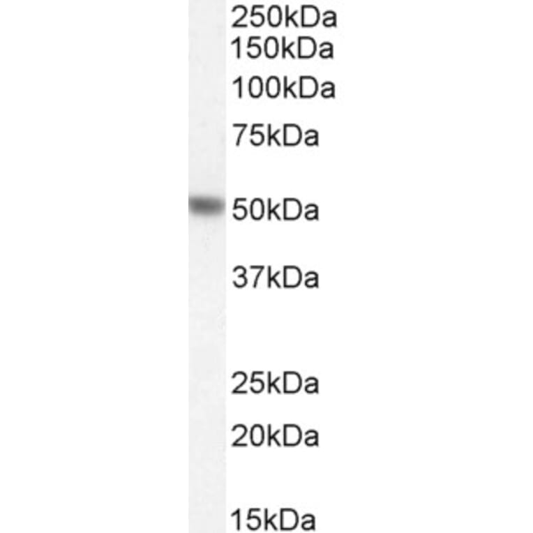 Western Blot - Anti-PAH Antibody (A84871) - Antibodies.com