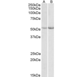 Western Blot - Anti-PAH Antibody (A84871) - Antibodies.com