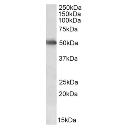 Western Blot - Anti-Cytochrome P450 2E1 Antibody (A84875) - Antibodies.com