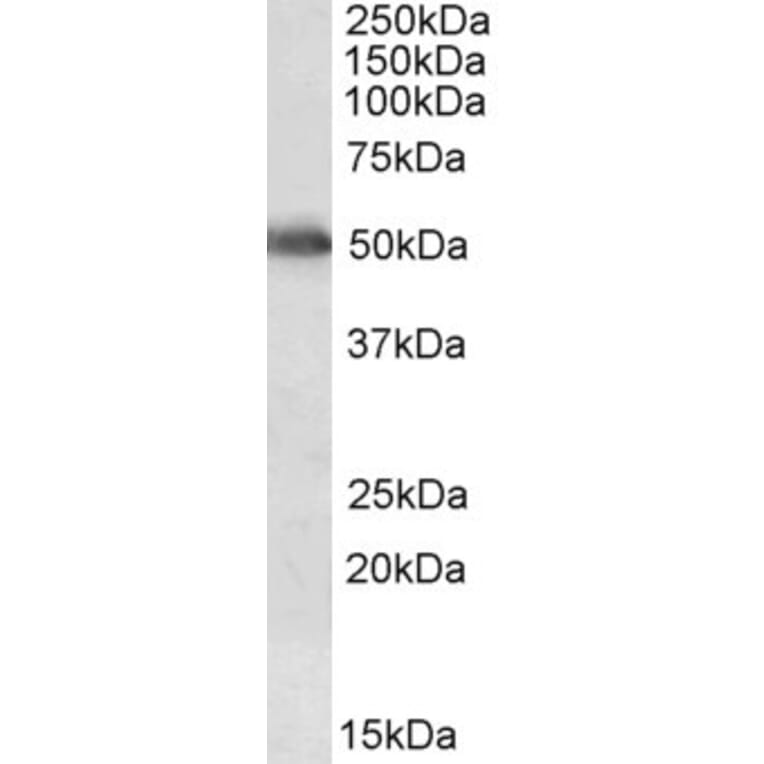 Western Blot - Anti-Cytochrome P450 2E1 Antibody (A84875) - Antibodies.com