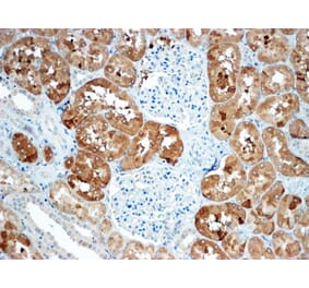 Immunohistochemistry - Anti-SOST Antibody (A84880) - Antibodies.com