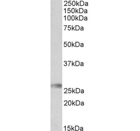 Western Blot - Anti-HLA-DQA2 Antibody (A84881) - Antibodies.com