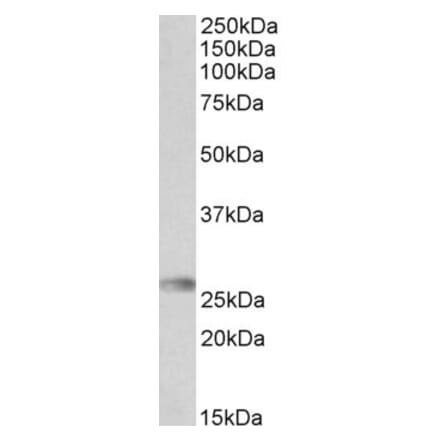 Western Blot - Anti-HLA-DQA2 Antibody (A84881) - Antibodies.com