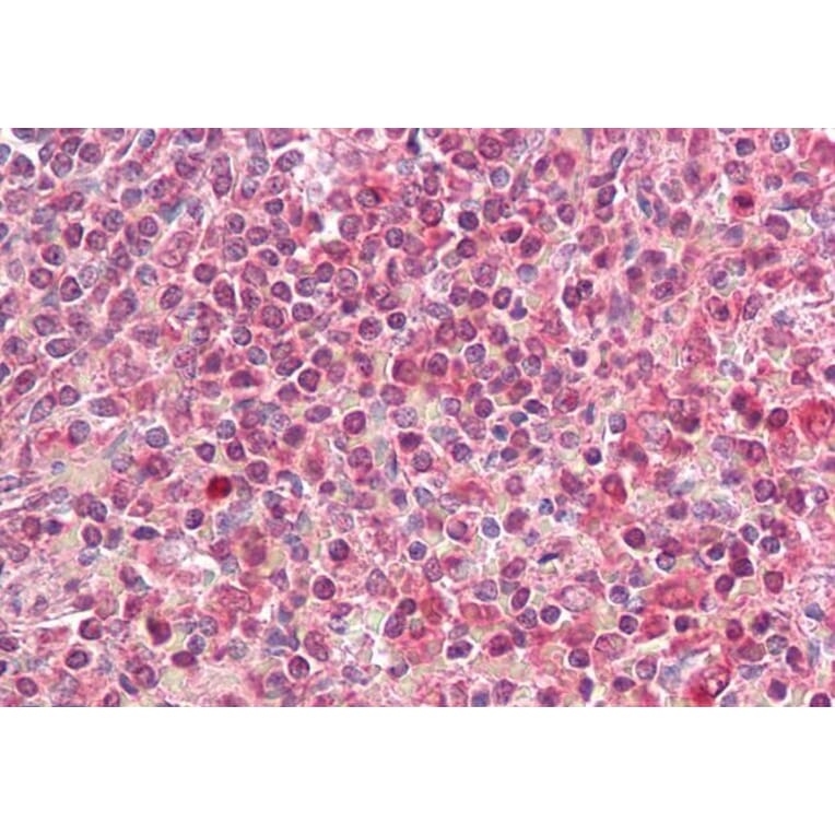 Immunohistochemistry - Anti-HLA-DQA2 Antibody (A84881) - Antibodies.com