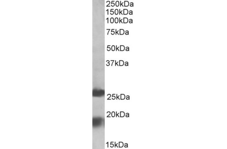 Western Blot - Anti-MPV17 Antibody (A84882) - Antibodies.com