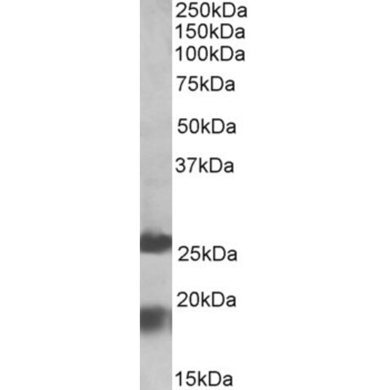Western Blot - Anti-MPV17 Antibody (A84882) - Antibodies.com