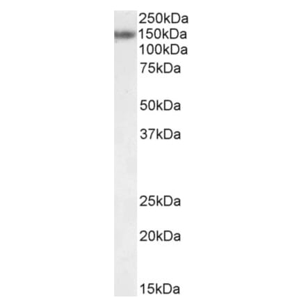 Western Blot - Anti-RBM20 Antibody (A84888) - Antibodies.com