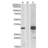 Western Blot - Anti-KCTD11/REN Antibody (A84889) - Antibodies.com