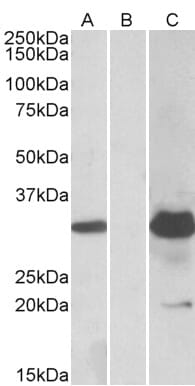 HEK293 lysate (10ug protein in RIPA buffer) overexpressing Human KCTD11 with DYKDDDDK tag probed with Anti-KCTD11 Antibody (A84889) (1.0µg/ml) in Lane A and probed with anti-DYKDDDDK Tag (1/5000) in lane C. Mock-transfected HEK293 probed with Anti-KCTD11 Antibody (A84889) (1mg/ml) in Lane B. Primary incubations were for 1 hour. Detected by chemiluminescence.