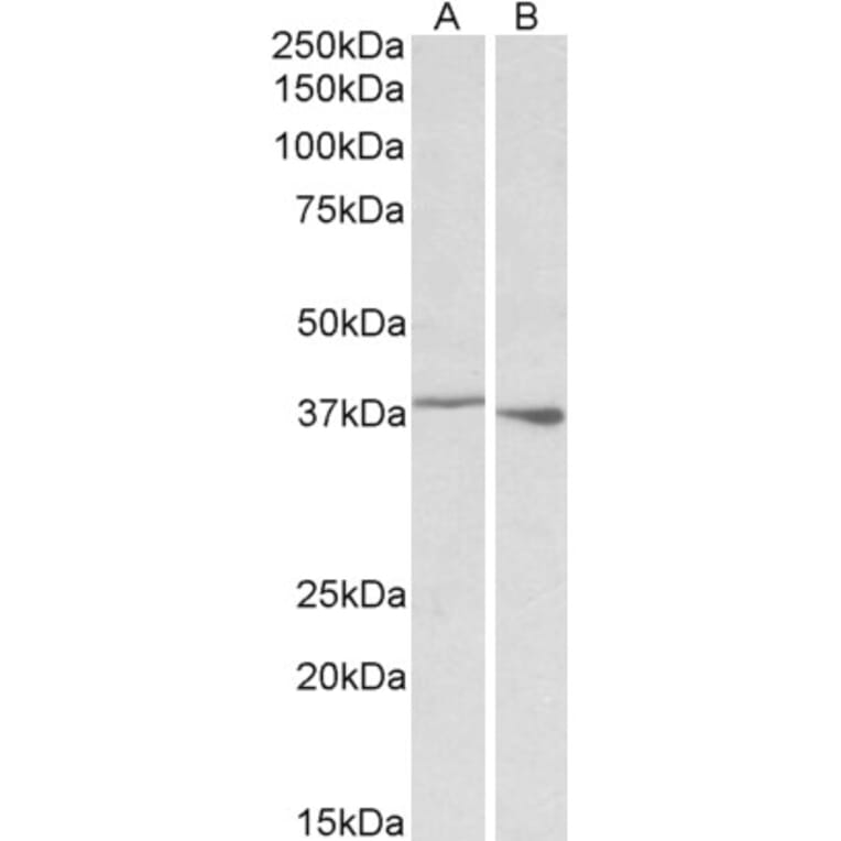 Western Blot - Anti-PCBP1 Antibody (A84893) - Antibodies.com