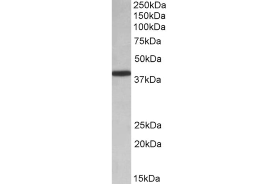 Western Blot - Anti-PCBP1 Antibody (A84894) - Antibodies.com