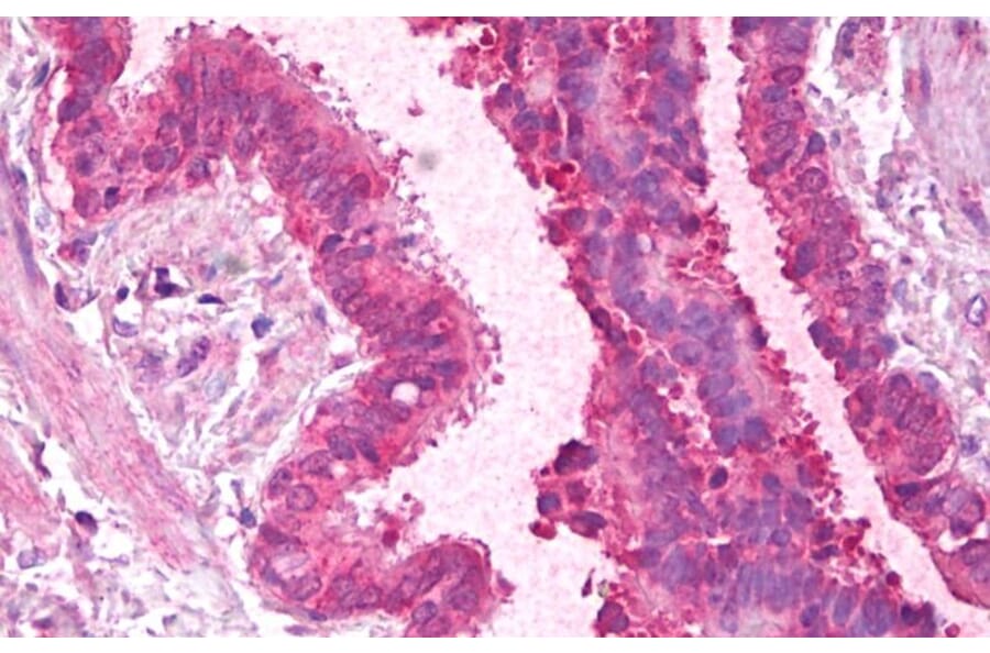 Immunohistochemistry - Anti-PCBP1 Antibody (A84894) - Antibodies.com