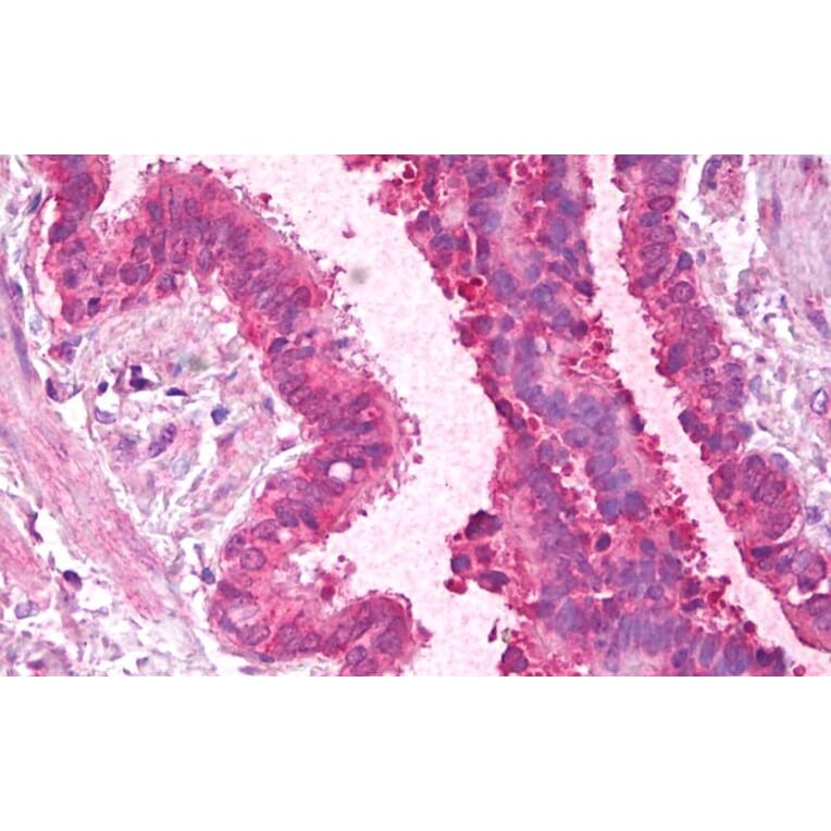 Immunohistochemistry - Anti-PCBP1 Antibody (A84894) - Antibodies.com
