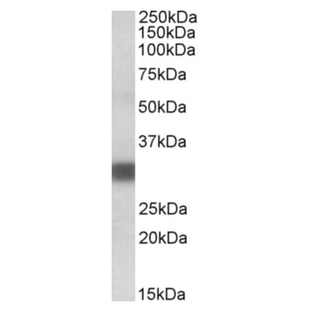 Western Blot - Anti-PDXP Antibody (A84897) - Antibodies.com