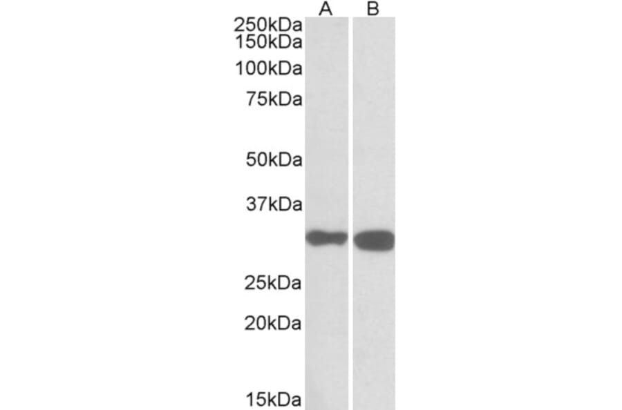 Western Blot - Anti-PDXP Antibody (A84897) - Antibodies.com