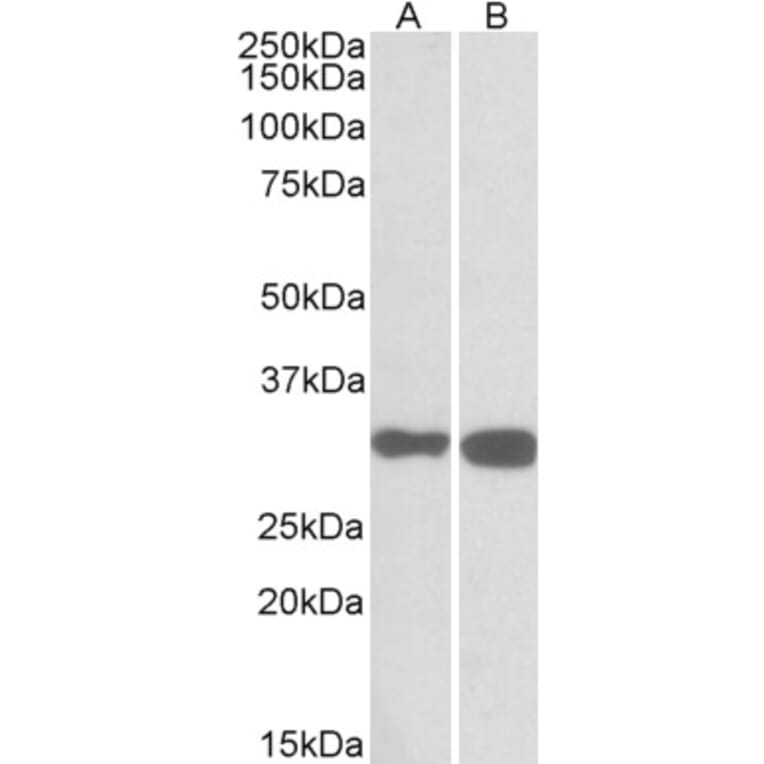 Western Blot - Anti-PDXP Antibody (A84897) - Antibodies.com