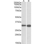 Western Blot - Anti-PDXP Antibody (A84897) - Antibodies.com