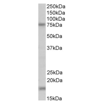 Western Blot - Anti-TGM7 Antibody (A84898) - Antibodies.com