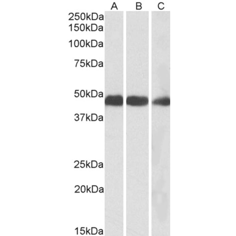 Western Blot - Anti-IDH2 Antibody (A84904) - Antibodies.com