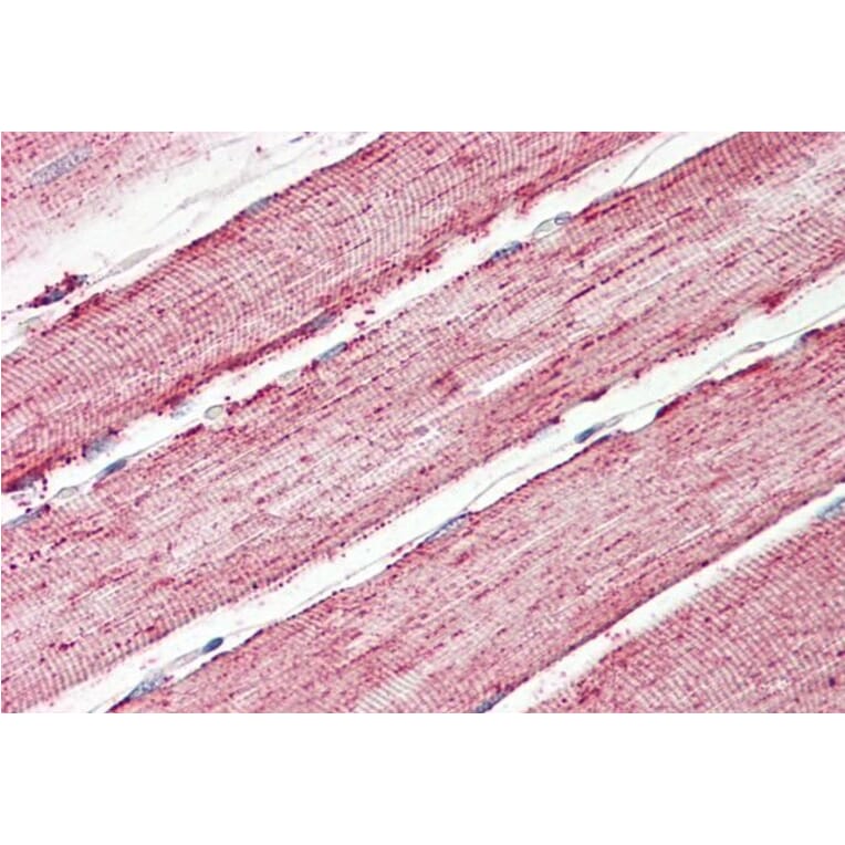 Immunohistochemistry - Anti-IDH2 Antibody (A84904) - Antibodies.com