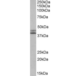 Western Blot - Anti-IDH1 Antibody (A84906) - Antibodies.com