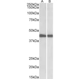 Western Blot - Anti-IDH1 Antibody (A84906) - Antibodies.com