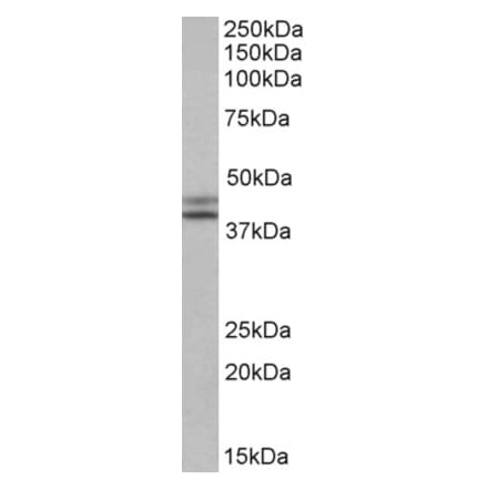 Western Blot - Anti-IDH1 Antibody (A84906) - Antibodies.com