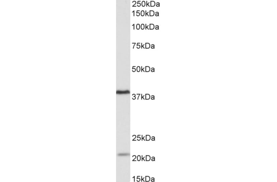 Western Blot - Anti-KLHDC8B Antibody (A84907) - Antibodies.com