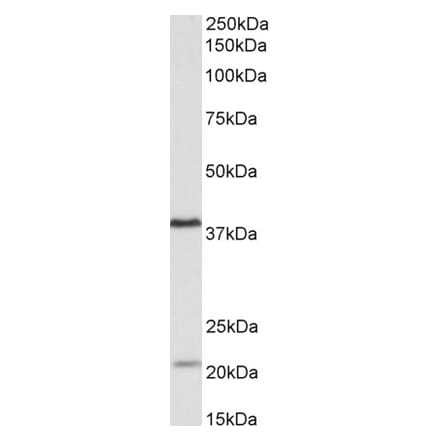 Western Blot - Anti-KLHDC8B Antibody (A84907) - Antibodies.com