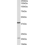 Western Blot - Anti-KLHDC8B Antibody (A84907) - Antibodies.com