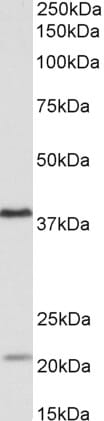 Anti-KLHDC8B Antibody (A84907) (0.5µg/ml) staining of Daudi lysate (35µg protein in RIPA buffer). Primary incubation was 1 hour. Detected by chemiluminescence.