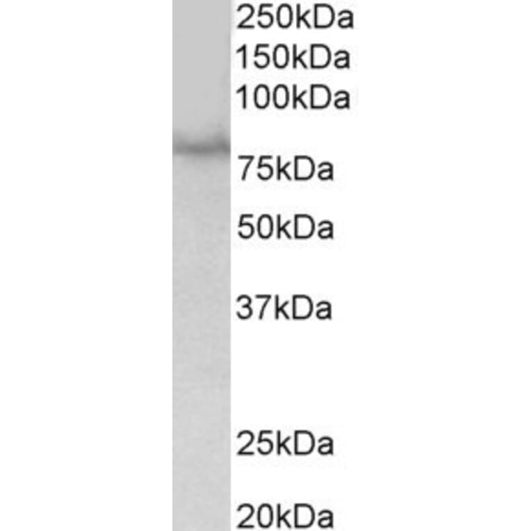 Western Blot - Anti-SIM1 Antibody (A84909) - Antibodies.com