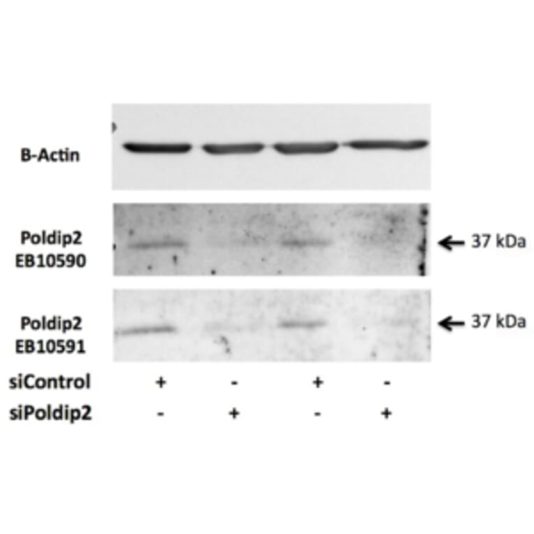 Western Blot - Anti-POLDIP2 Antibody (A84914) - Antibodies.com