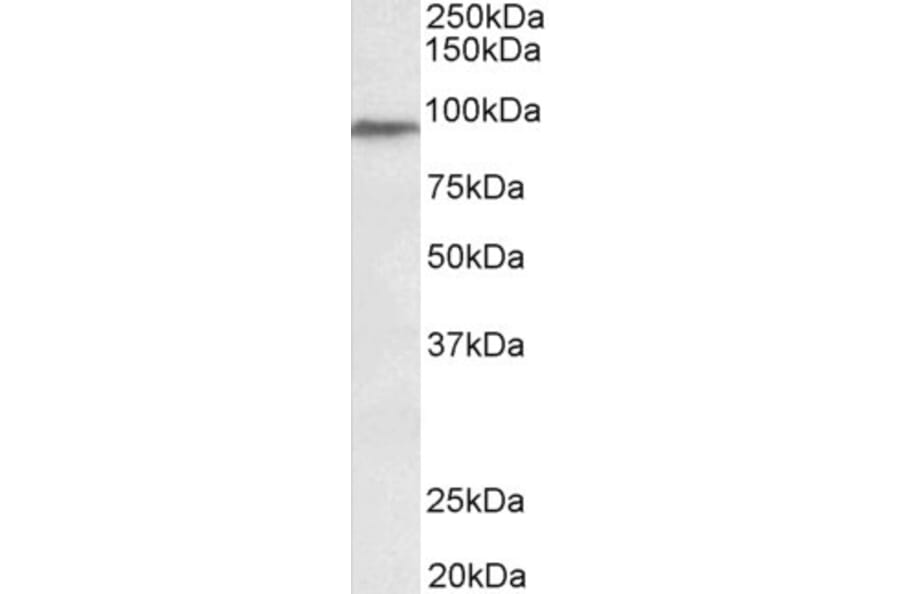 Western Blot - Anti-PTCHD3 Antibody (A84915) - Antibodies.com