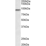 Western Blot - Anti-PTCHD3 Antibody (A84915) - Antibodies.com
